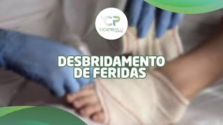 Desbridamento de feridas [upl. by Aldora]