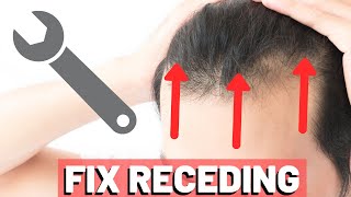 5 POWERFUL Receding Hairline TRICKS to INSTANTLY Improve Your Look [upl. by Zere]