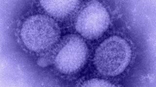 CDC H1N1 Swine Flu Response Actions and Goals [upl. by Robbie659]