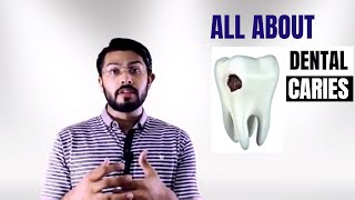 Dental Caries explained EASY [upl. by Marcia]