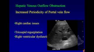 Ultrasound Imaging of Portal Hypertension [upl. by Pearlstein]