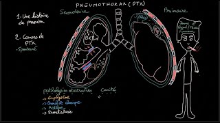 Pneumothorax  Docteur Synapse [upl. by Aigroeg]