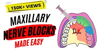 Maxillary Nerve Block Anesthesia For Dental Procedures [upl. by Waine]