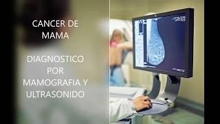 Biopsias de mama Cómo y cuando [upl. by Getraer]