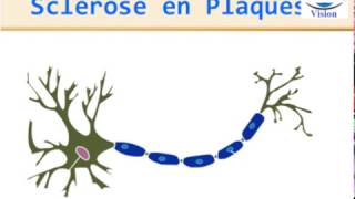 Sclérose en Plaques Physiopathologie Symptomes Diagnostic IRM traitement [upl. by Decker]