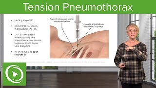 Tension Pneumothorax EMERGENCY Dont Miss This Crucial Diagnosis [upl. by Ewall]