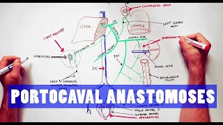 Portocaval Anastomoses  ANATOMY Tutorial [upl. by Marsland747]