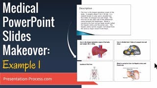 Medical PowerPoint Slides Makeover Example 1 [upl. by Yenolem422]