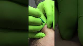 Microdermal piercing [upl. by Nitsirk]