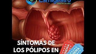 Todo sobre PARÁSITOS INTESTINALES Síntomas medicamentos y prevención [upl. by Elleyoj]