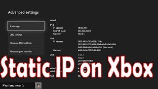 How to Setup Static IP on Xbox One [upl. by Morra586]