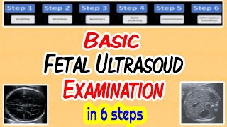 Craniosynostosis Treatment Options for Sagittal Synostosis  Part 5 of 6 [upl. by Broddie]