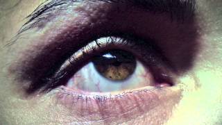 Tratamiento del glaucoma con homeopatía [upl. by Sartin]