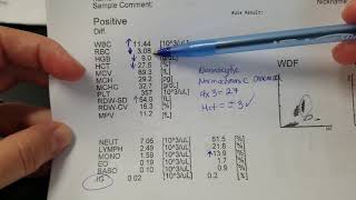 Hematology How to interpret automated Complete Blood Count CBC results [upl. by Kcirddahc]