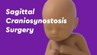 Craniosynostosis  FAQ with Pediatric Neurosurgeon Eric Jackson MD [upl. by Gnouhc]