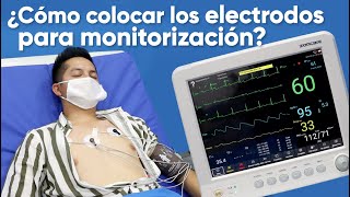 ¿Cómo colocar los electrodos para monitorización [upl. by Hyps]