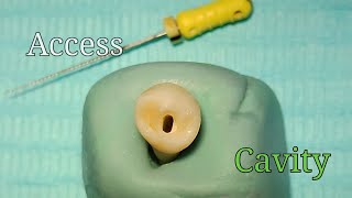 Access Cavity Preparation  Mandibular First Premolar [upl. by Najram]