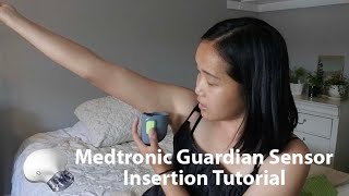 MEDTRONIC GUARDIAN SENSOR INSERTION TUTORIAL [upl. by Arhaz424]