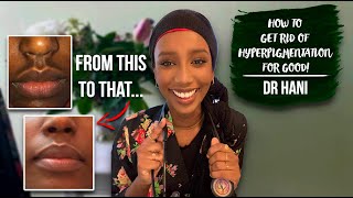 How To Get Rid Of Hyperpigmentation  Dr Hani [upl. by Sotos]