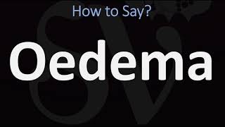 How to Pronounce Oedema CORRECTLY [upl. by Adgam]