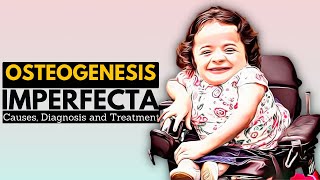 OSTEOGENESIS IMPERFECTA OI Causes Signs and Symptoms Diagnosis and Treatment [upl. by Ettenan149]