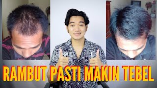 3 BULAN MENEBALKAN RAMBUT  pejuangganteng [upl. by Ordnasil]