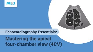 Echocardiography Essentials Mastering the apical fourchamber view 4CV [upl. by Htaras]