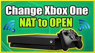 How to Change Xbox One NAT to OPEN and FIX Strict Connection Issues Easy Method [upl. by Dorn]