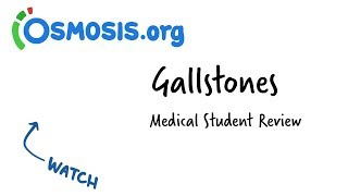 Gallstones  Clinical Presentation [upl. by Higgs438]