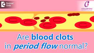 Why does menstrual bleeding have blood clots Is it normalDrShalini Varma of Cloudnine Hospitals [upl. by Iloj999]