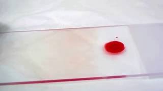 Geste technique  frottis sanguin  Blood smear [upl. by Eahsal]