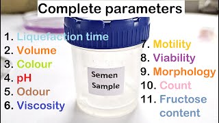 Sperm Count Testing as Viewed Through a Microscope [upl. by Millhon]