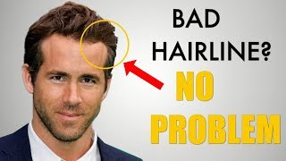 5 Awesome Hairstyles for Widows Peak  Receding Hairline [upl. by Rheba]