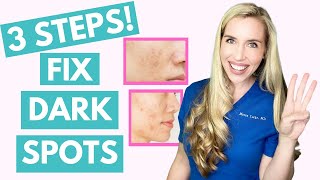 Fix Your Dark Spots in 3 Steps  Hyperpigmentation  Melasma  Skincare Made Simple [upl. by Shuma]