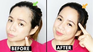 How To Naturally Grow Back Thinning Hairline amp Cover up Receding HairlineBeautyklove [upl. by Nitsugua]