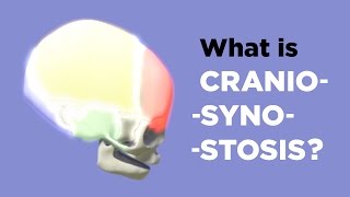 Craniosynostosis What to Expect on Surgery Day  Part 4 of 6 [upl. by Hazem]