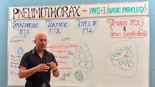 Pneumothorax  Spontaneous Tension amp Traumatic🫁 [upl. by Clementius]