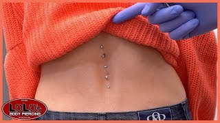 5 Back Dermal Piercings In 1 Day [upl. by Eidnalem444]