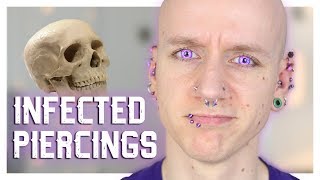 Infected Piercings amp How To Heal Them  Piercing FAQ 21  Roly [upl. by Nesnej68]