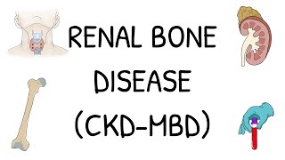 Renal Bone Disease CKDMBD  Explained simply and clearly [upl. by Sivart]