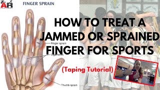 How To Treat a Jammed or Sprained Finger For Sports [upl. by Darrill]