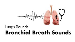 Bronchial Breath Sounds  Lung Sounds  Medzcool [upl. by Melinda]