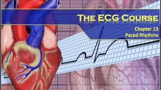 The ECG Course  Paced Rhythms [upl. by Giglio]