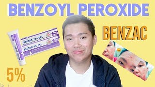 Benzac Benzoyl Peroxide 5 Review for Acne Philippines [upl. by Arik153]