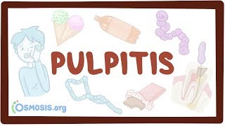 Pulpitis  causes symptoms diagnosis treatment pathology [upl. by Beare]