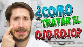 🔴 OJO ROJO ¿como puedo tratarlo [upl. by Emersen]