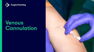 Intravenous IV Cannulation  An Essential Guide [upl. by Ku]