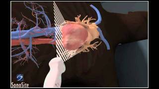 Echocardiography Essentials Mastering the apical fourchamber view 4CV [upl. by Robyn]