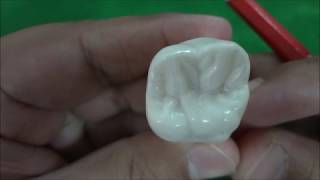 Maxillary Permanent First Molar Morphology [upl. by Alius]