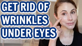 How to GET RID OF UNDER EYE WRINKLES Dr Dray [upl. by Zehe]